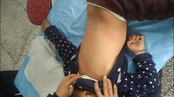 国产揪痧视频在线观看,跟随国产视频轻松学习居家养生技巧